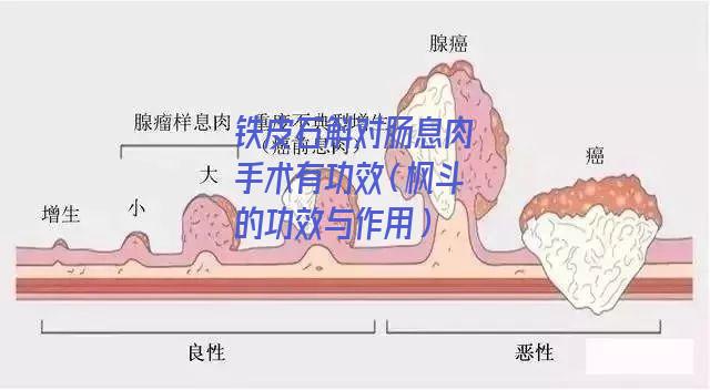 铁皮石斛对肠息肉手术有功效