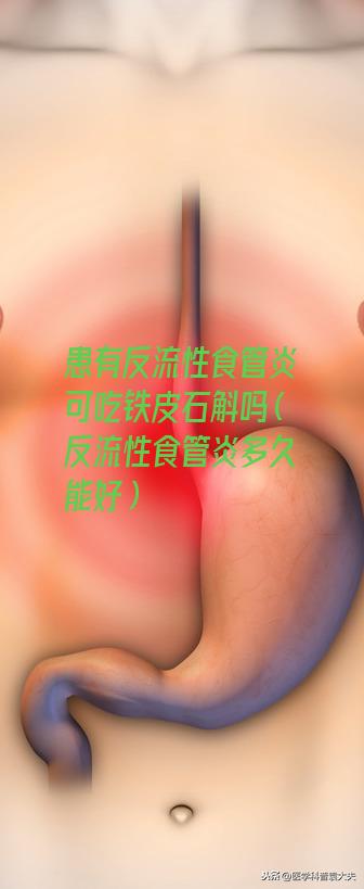 患有反流性食管炎可吃铁皮石斛吗