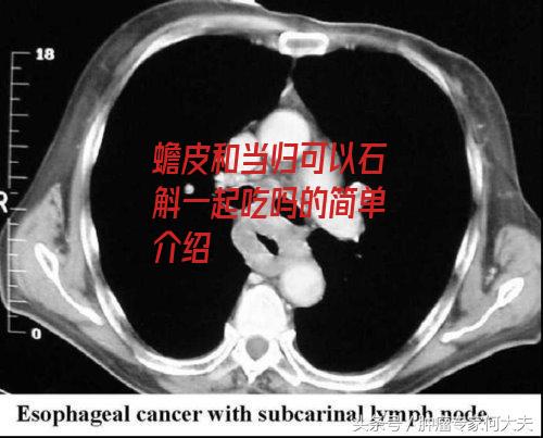 蟾皮和当归可以石斛一起吃吗