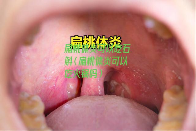 扁桃体炎可以吃石斛